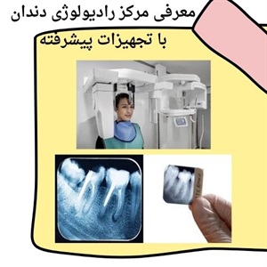 مزایای استفاده از خدمات تخصصی رادیولوژی دندان سعادت آباد